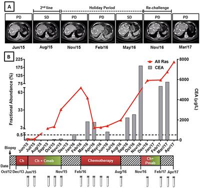 Circulating Tumor DNA Detection in the Management of Anti-EGFR Therapy for Advanced Colorectal Cancer